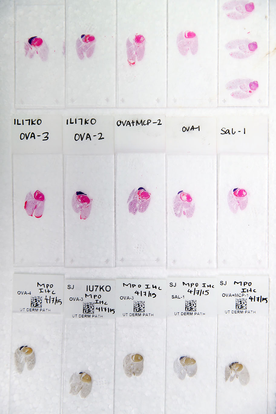 Histology slides to look for airways disease.